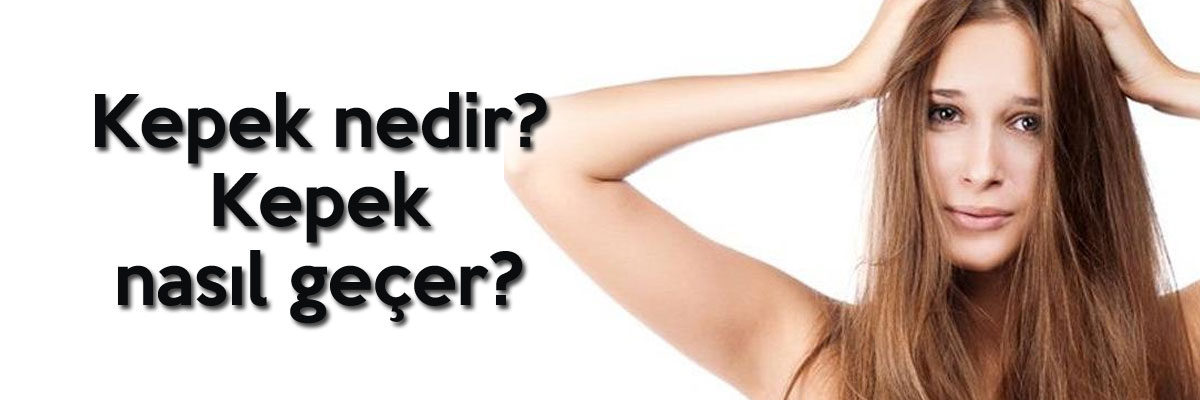 Kepek nedir? Kepek nasıl geçer?
