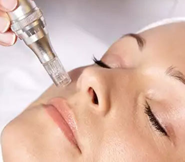Dermapen